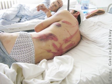 Biciuit până la sânge 