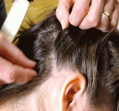 Germania – şi bogaţii au păduchi câteodată