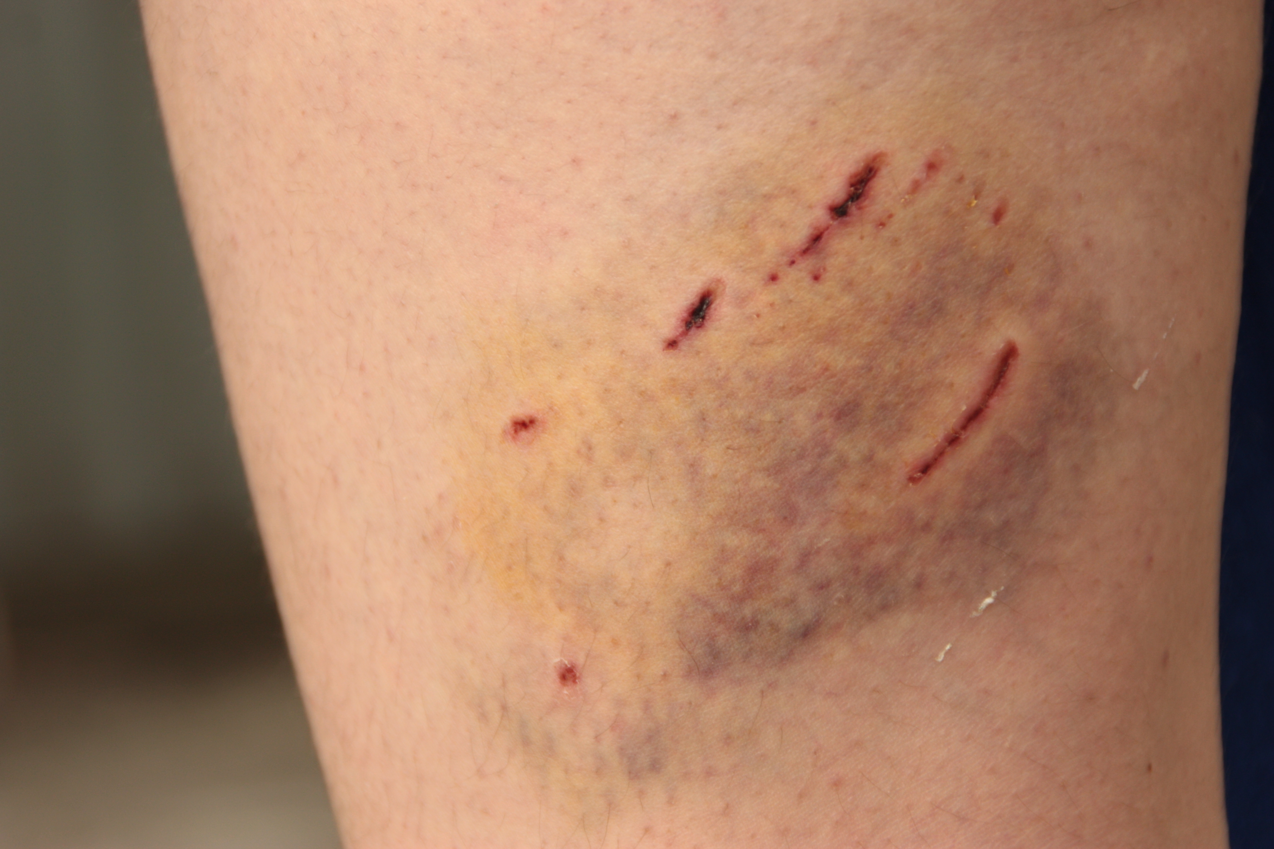 Femeie ATACATĂ şi MUŞCATĂ de maidanezi în Grădina Botanică. Dovada că autorităţile NU-ŞI FAC DATORIA