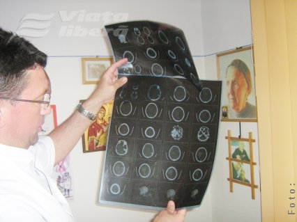 Viaţă redată cu bisturiul