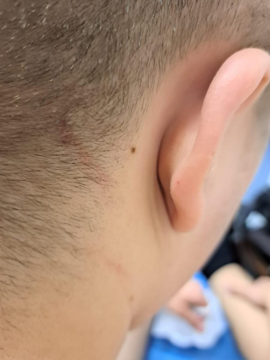 Doi fraţi acuză că au fost bătuţi de agenţii de pază la Balul bobocilor