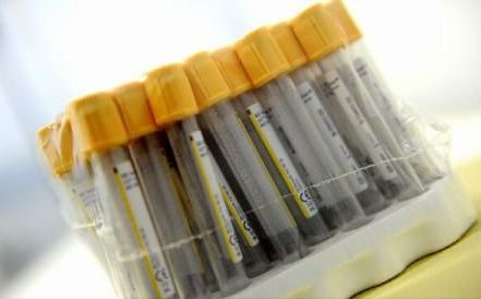 Nou antibiotic, deosebit de eficient