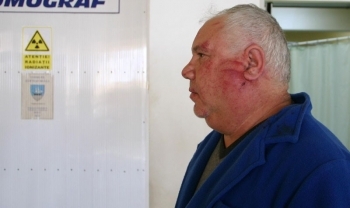 BRĂILA: Autopsier bătut de romi în faţa Spitalului