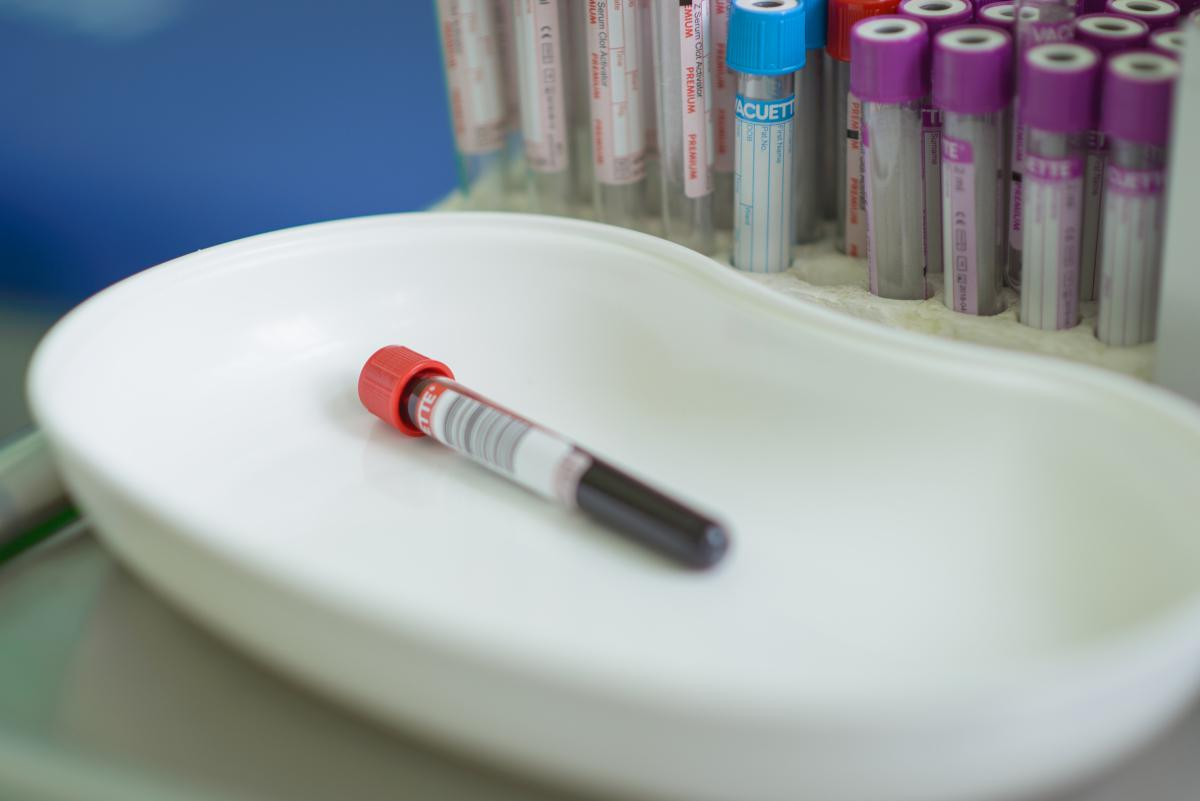 Categorii de risc care trebuie testate