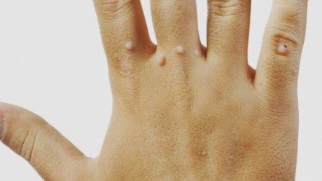 Negii nu trebuie tăiaţi