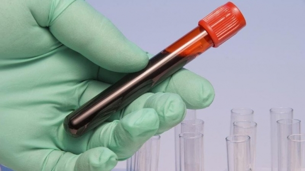 Depozitul e plin, farmaciile spitalelor sunt goale!