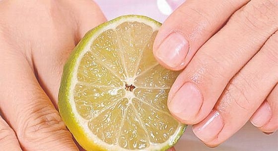 Frumuseţe şi îngrijire. Tratarea unghiilor cu probleme (II)