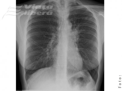Gălăţeni condamnaţi la suferinţă 
