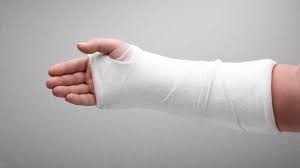 24 de persoane au ajuns la SPITAL din cauza POLEIULUI