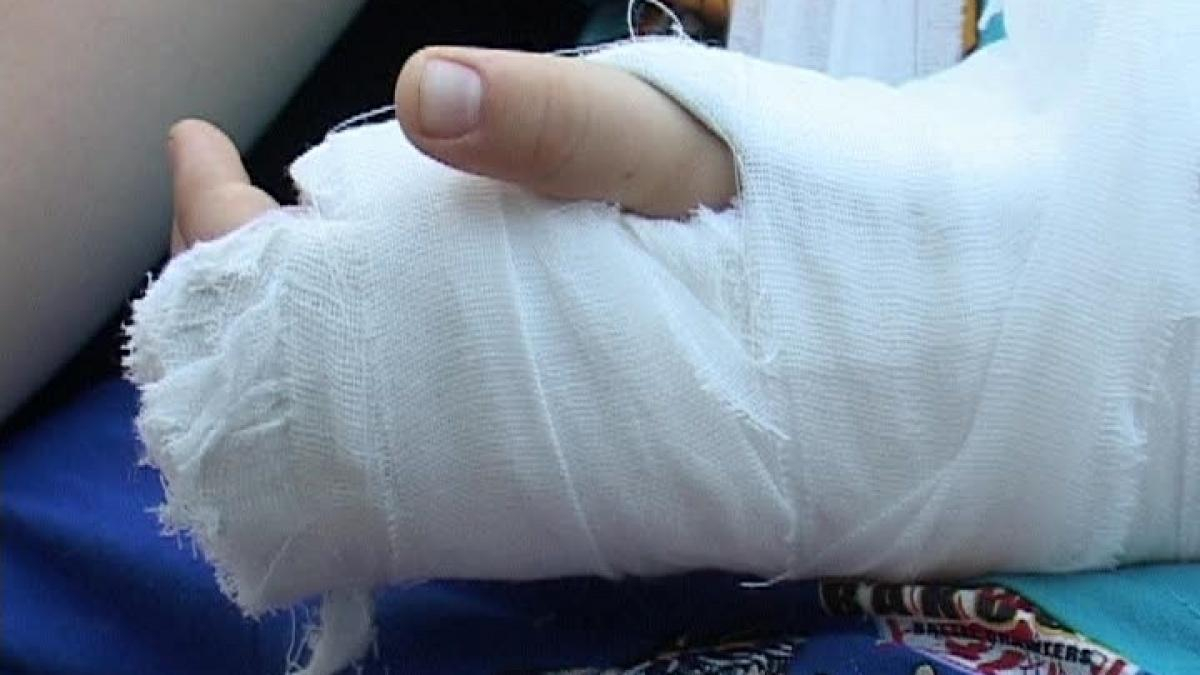 Diabetul de tip 1 ar putea predispune la fracturi