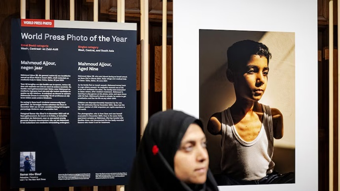 „Fotografia anului”, un copil palestinian cu brațele amputate