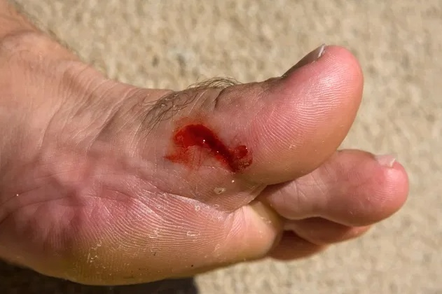 Aproape 2.000 de doze de vaccin antitetanic sunt în drum spre Galaţi