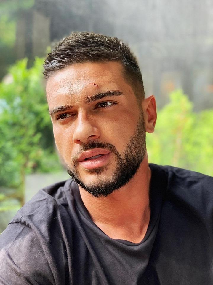 Dorian Popa, accidentat pe platourile de filmare