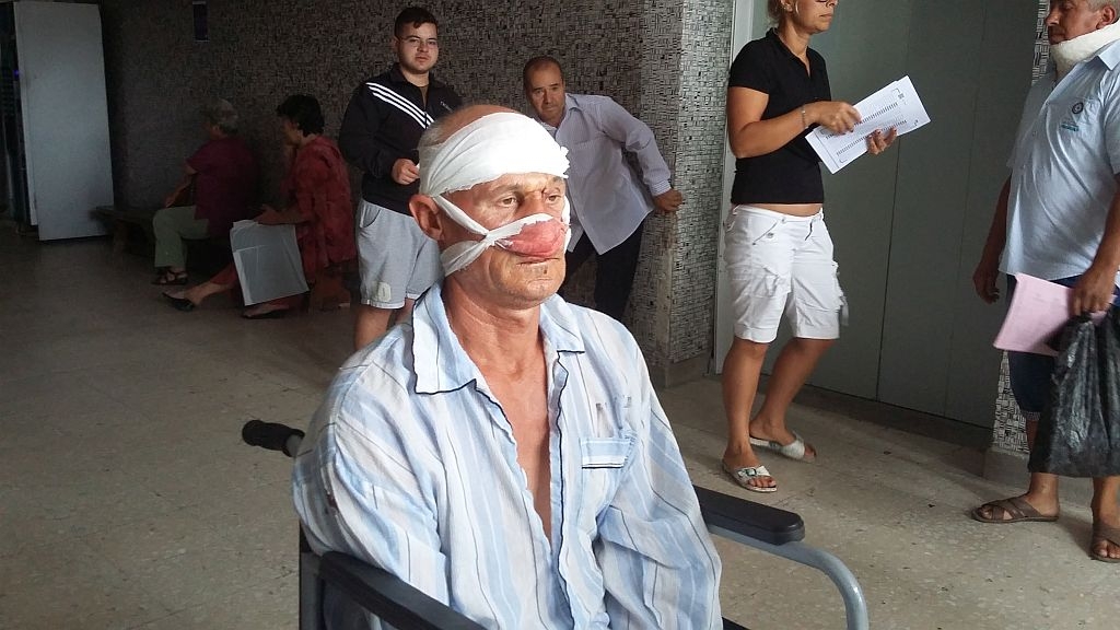 REGLARE DE CONTURI cu pumnii. BĂTAIE între vecini, de la o vacă şi doi salcâmi