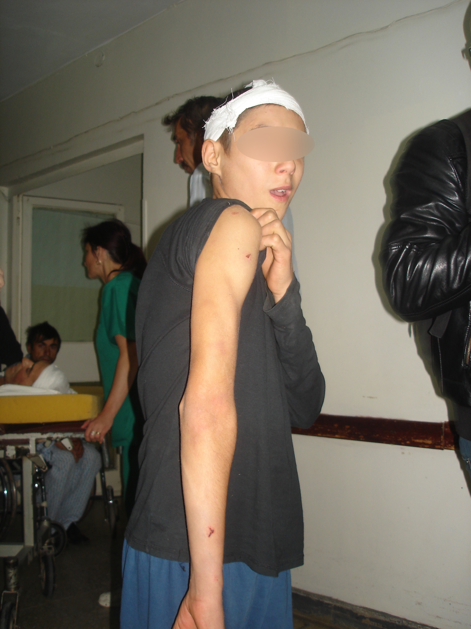 Tuluceşti - Copil lovit cu o ţeava de metal de către un vecin