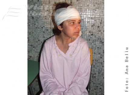 Desfigurată de amantul autoritar