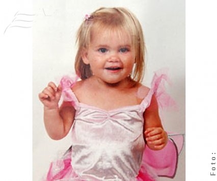 Nepoţică şi bunică accidentate pe zebră