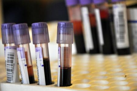 NEWS ALERT/ Un român întors din Nigeria, SUSPECT DE EBOLA