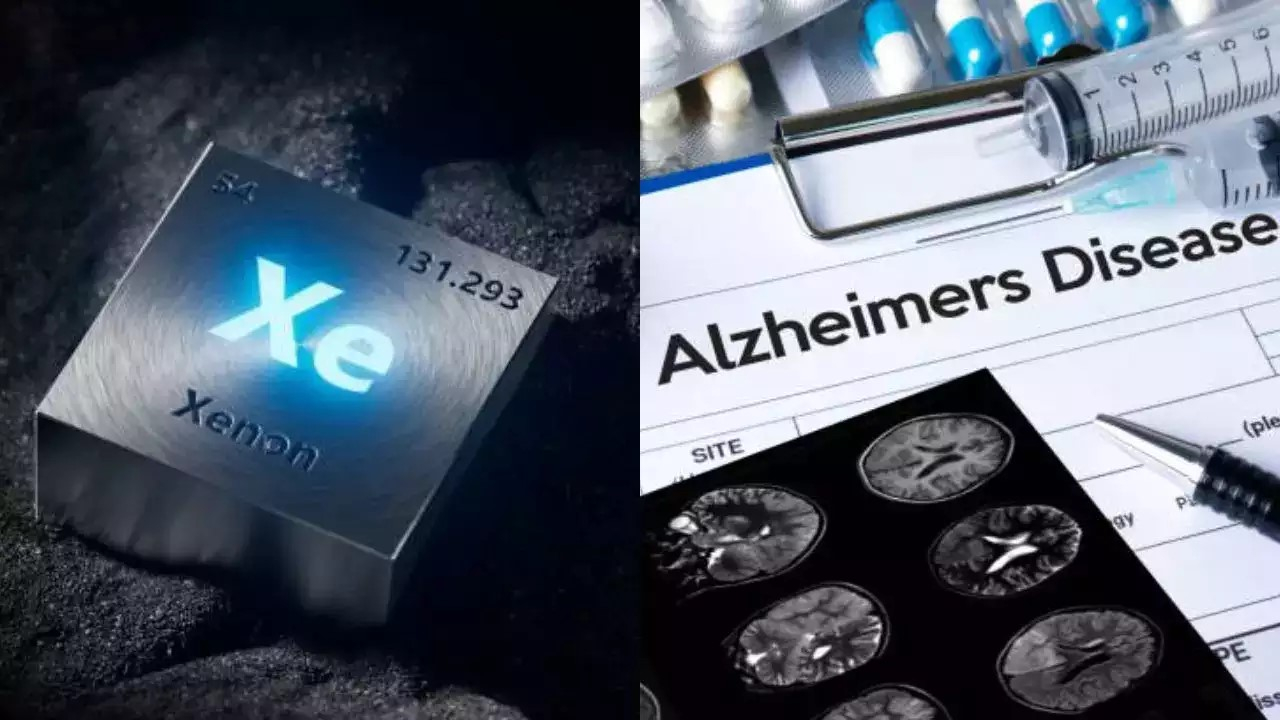 Inhalarea unui gaz nobil, tratament pentru Alzheimer