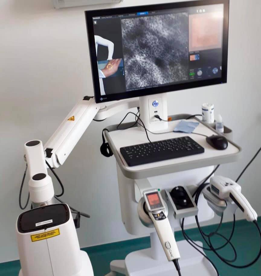 Tehnologie pentru depistarea cazurilor de cancer de piele la Galaţi