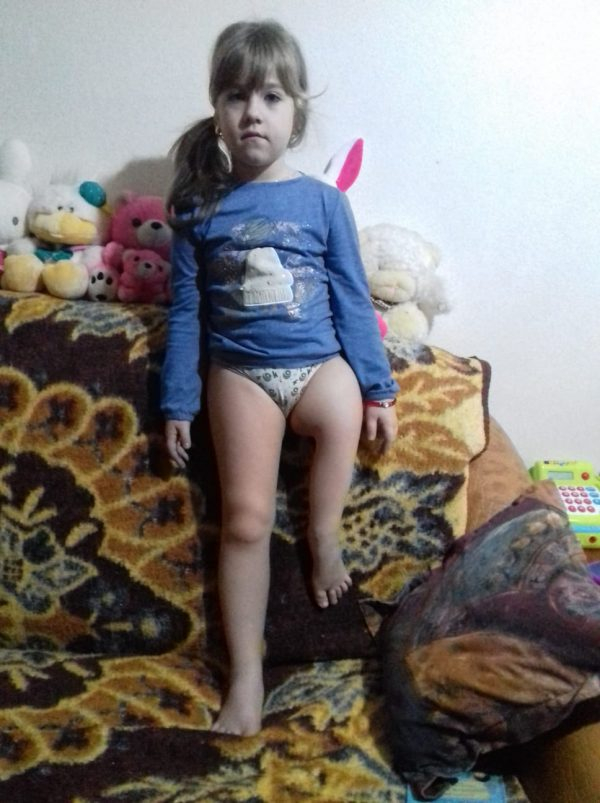 Ajutor pentru ca Bianca să poată merge