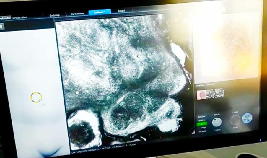 Cercetări dermatologice la Spitalul de Boli Infecțioase