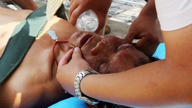 Informaţii de sezon: Cum procedăm dacă avem insolaţie 