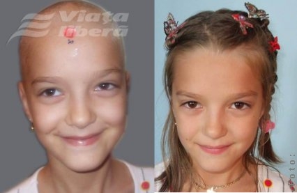 Simona, 9 ani – când soarele are cancer