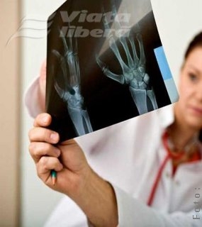 Gălăţenii şi povara osteoporozei 