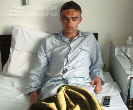 „Musafir” tăiat pe faţă   