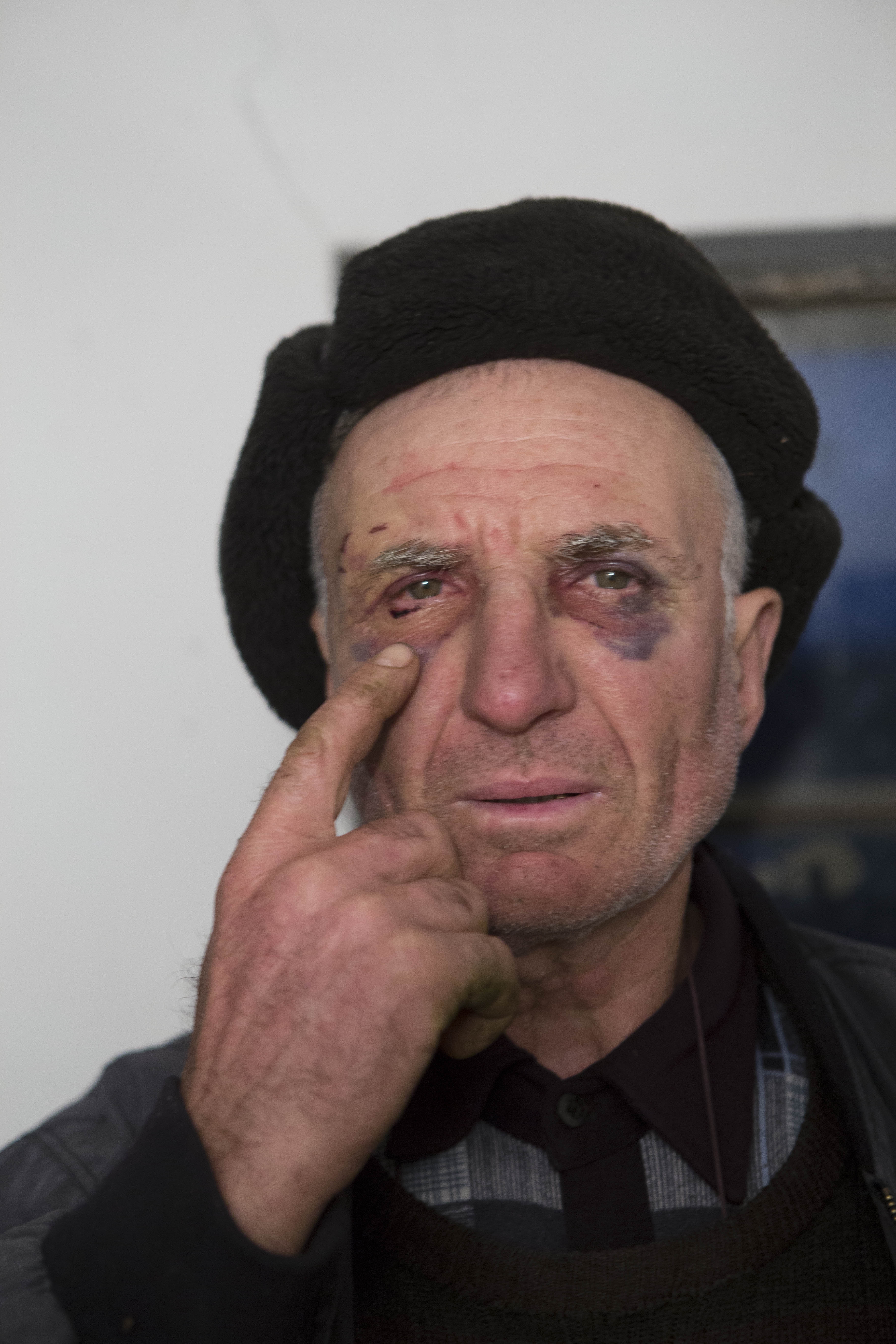 Un bărbat din Frumuşiţa a fost bătut de un fost poliţist de frontieră 