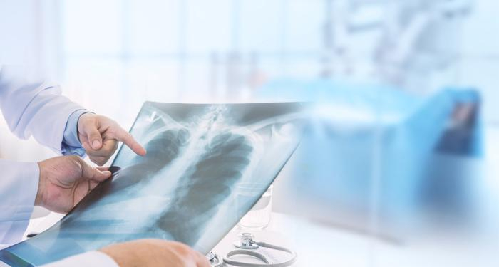 Sute de pacienți cu viroze și pneumonii