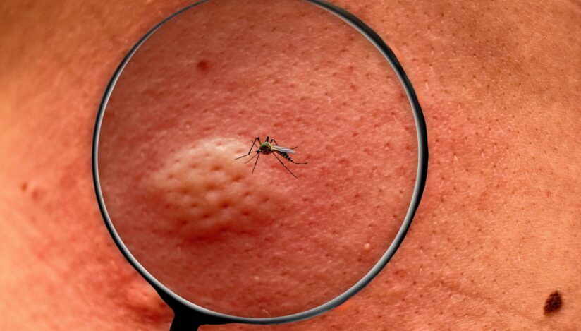 Cinci cazuri de infectare cu virusul West Nile la Galaţi