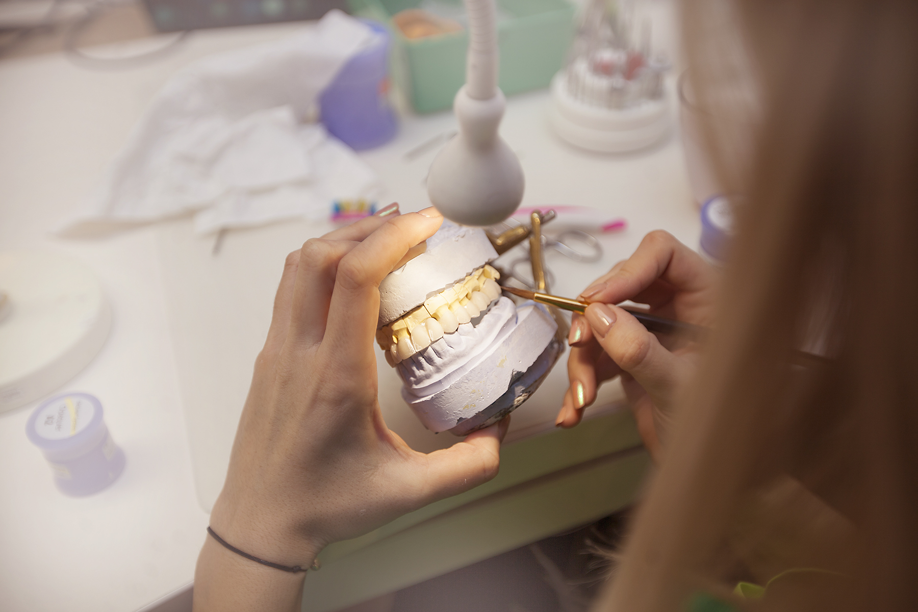 Dinți ficși în 24 de ore cu sistemul All-on-6 Straumann