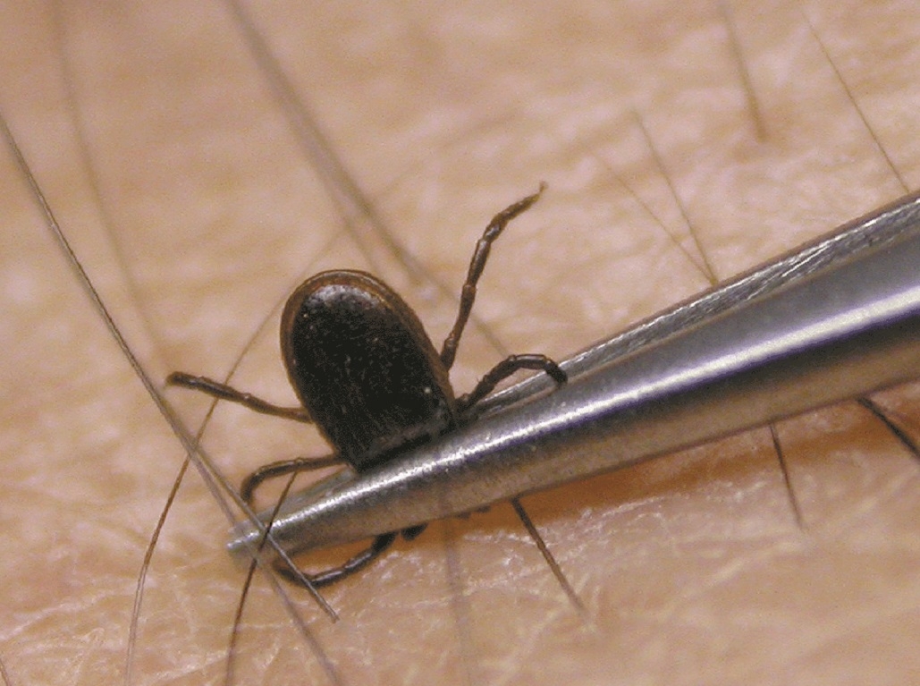 Numărul gălăţenilor muşcaţi de CĂPUȘE, mult mai mare decât cel din 2015