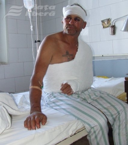 Împuns în ochi cu furca