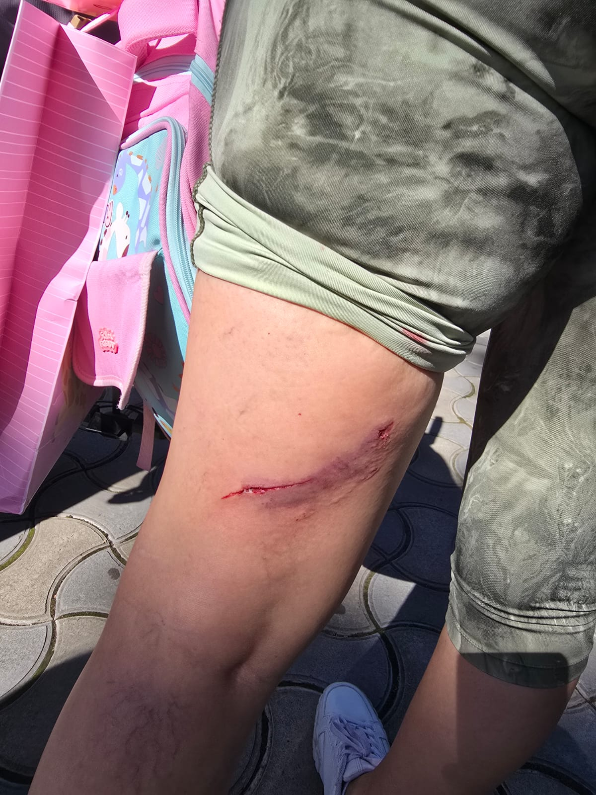 UPDATE. Amendă uriașă pentru stăpânul câinelui care a mușcat o mamă nevăzătoare