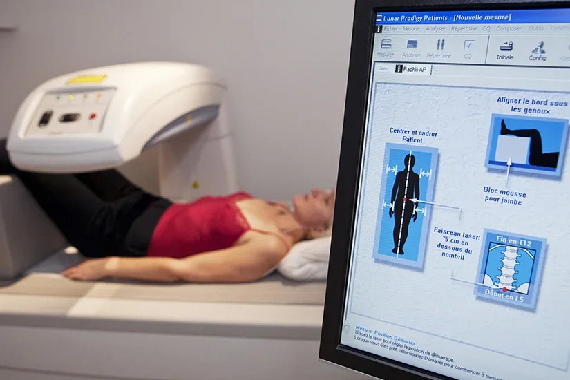 Osteoporoza, cea mai frecventă boală osoasă