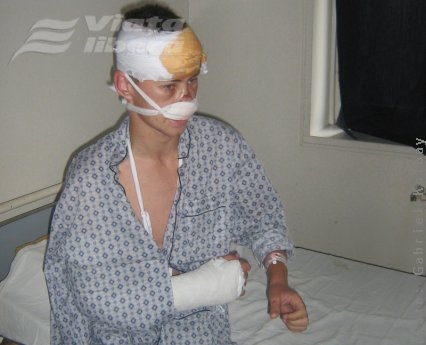 Desfigurat de necunoscuţi 